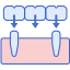 Zahnimplantat icon