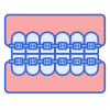 Braces icon