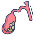 Gallbladder Disease icon