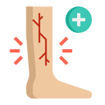 Varicose Veins icon