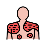 Psoriasis icon