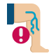 Varicose Veins icon