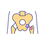 external Hip-Implant-arthritis-filled-color-icons-papa-vector icon