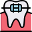 external brace-dental-color-obivous-color-kerismaker icon