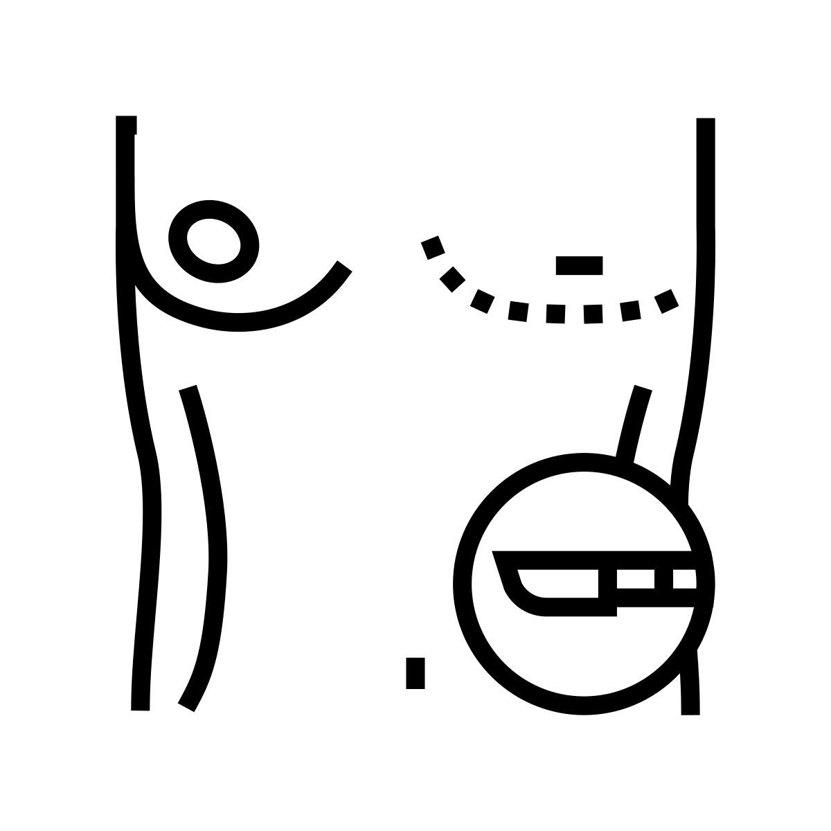 breast gynecomastia icon