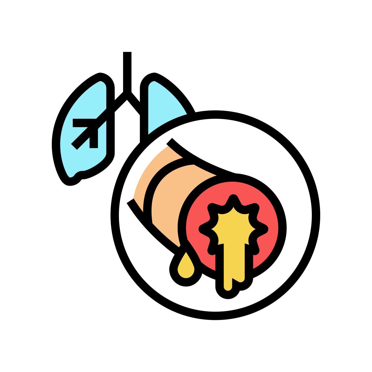 bronchiectasis icon