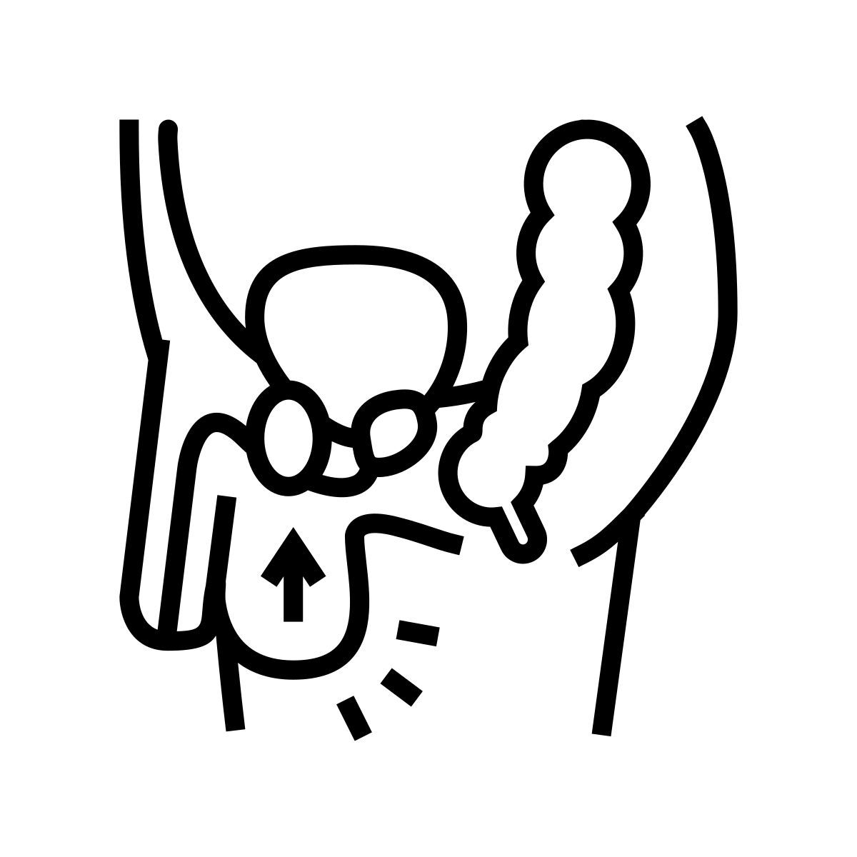 cryptorchidism icon
