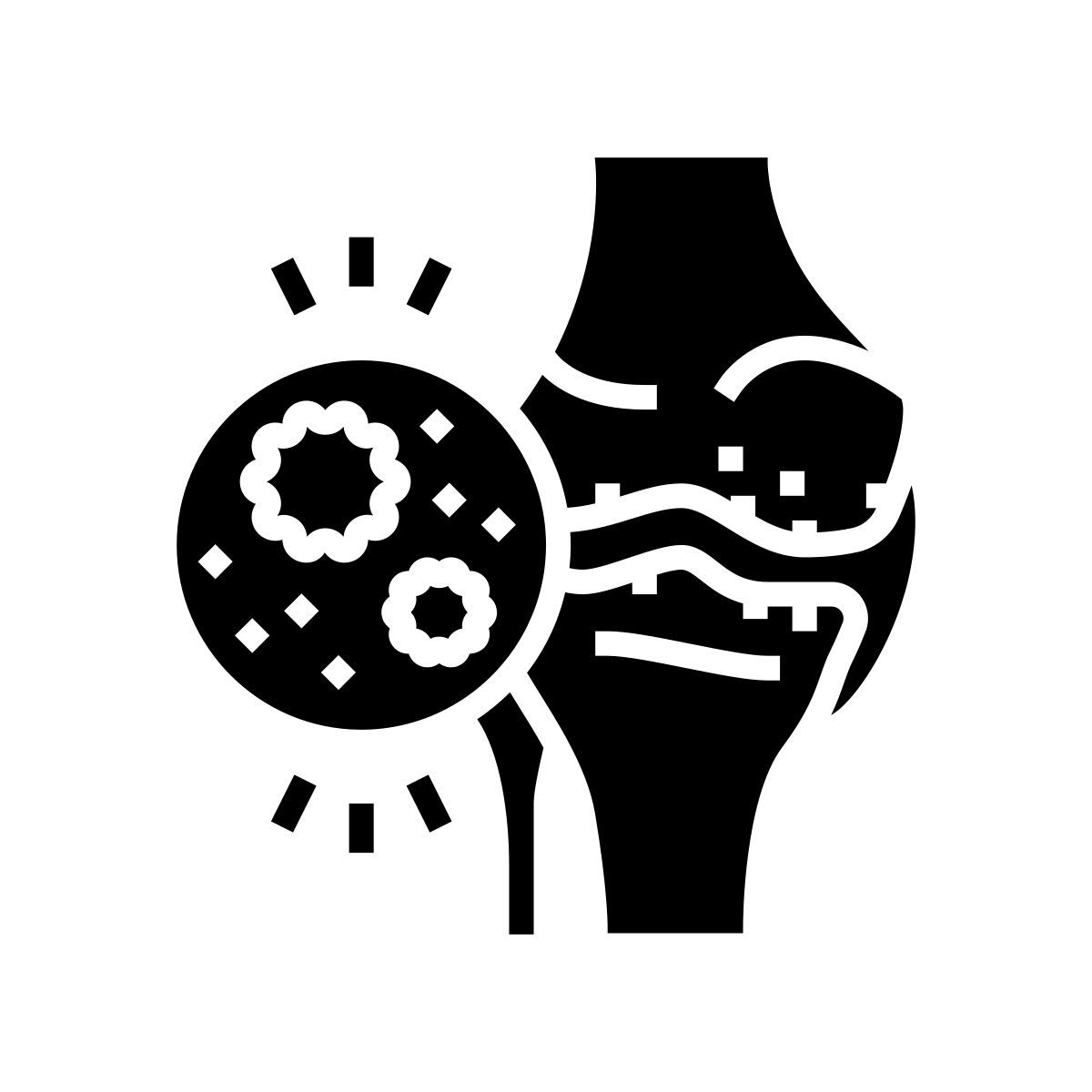 infectious arthritis icon